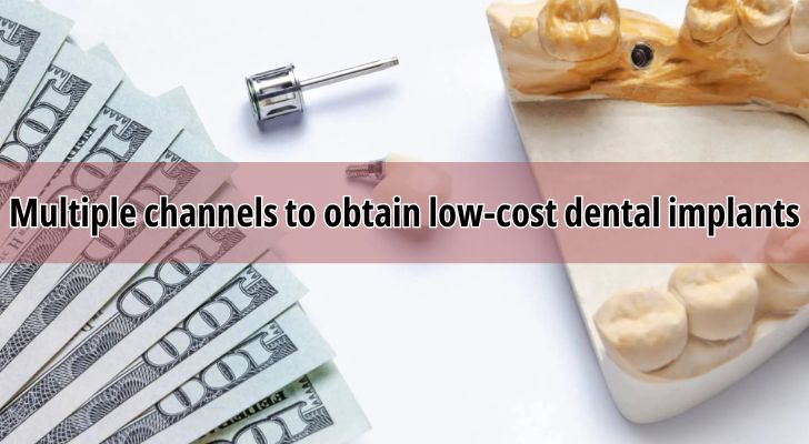 How to Get Affordable Dental Implants in the United States？