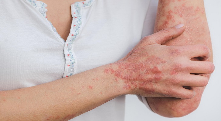 Are You Aware of the Most Common Skin Diseases and Their Triggers?